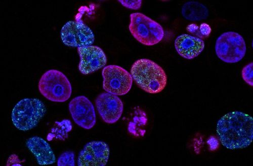 瑞士生物科技公司invasight利用突破性的細胞間蛋白靶點發現平臺,開發蛋白質 蛋白質相互作用抑制劑,靶向治療侵襲性癌癥 瑞士創新100強